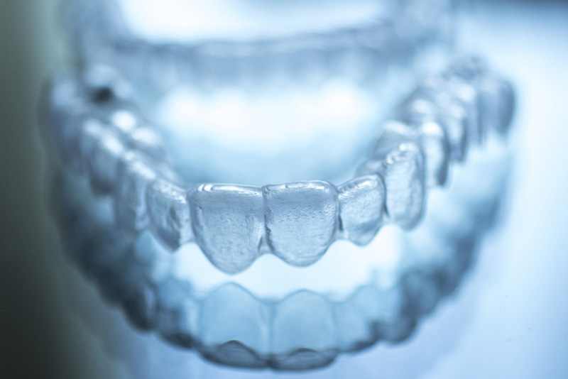 invisalign in calgary