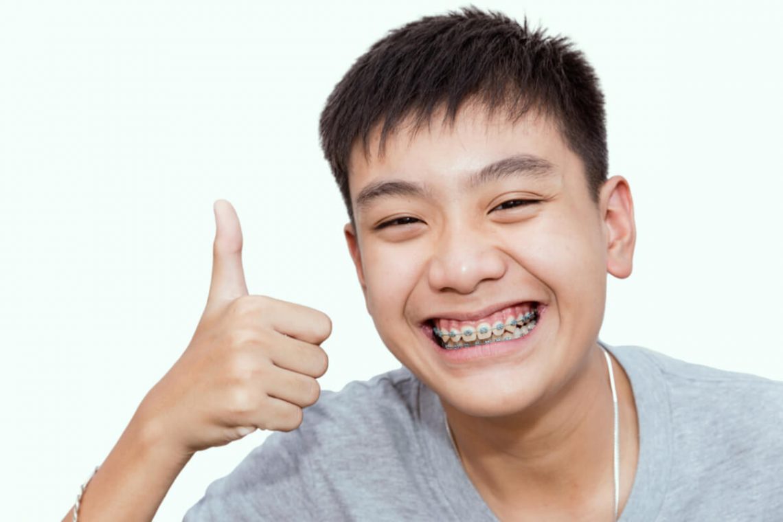 Does Getting Braces Hurt?
