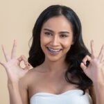 5 compelling reasons to consider adult braces