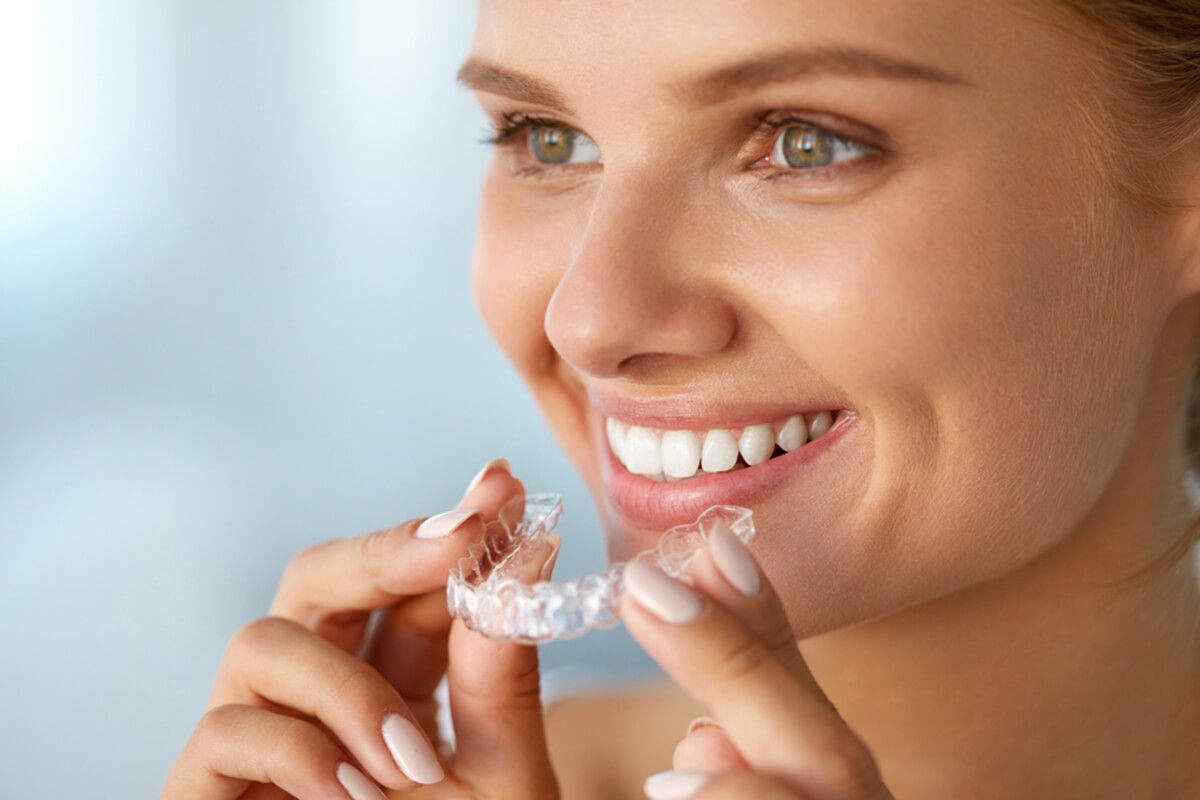 what to expect after invisalign treatment is complete