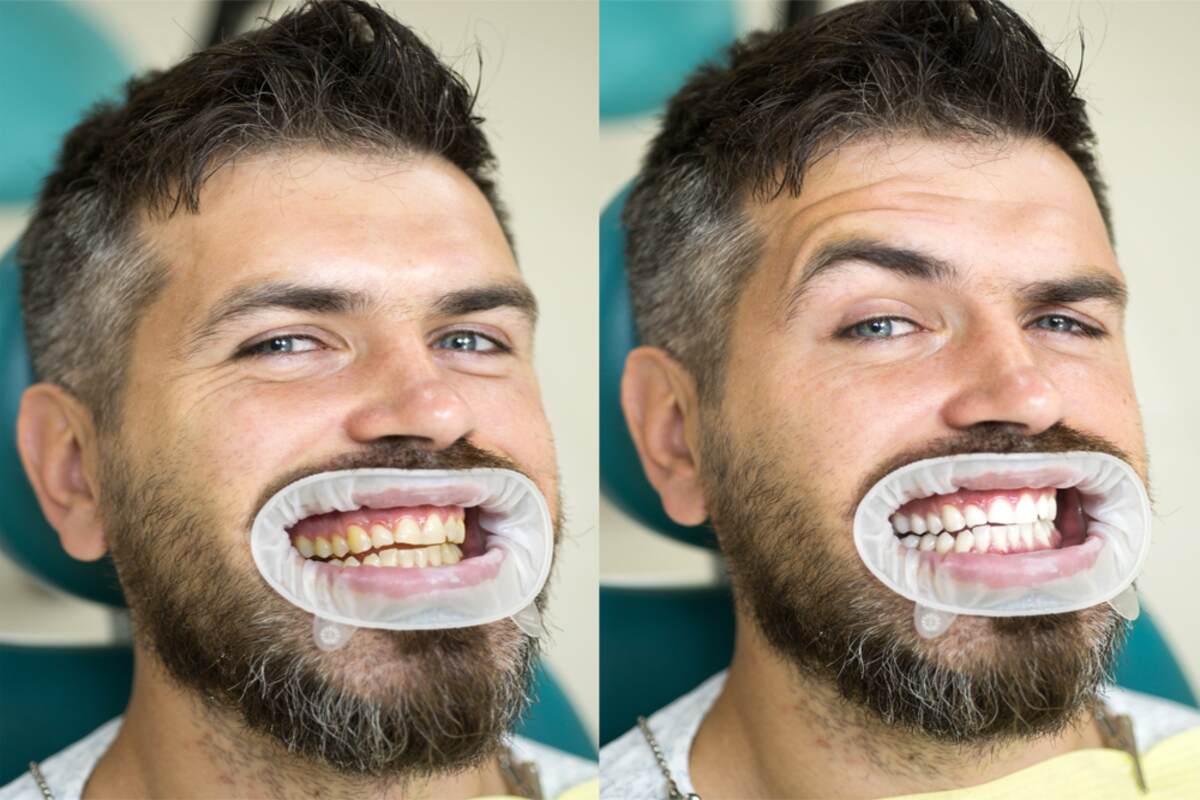 Top 5 Reasons Why You May Need Surgical Orthodontics