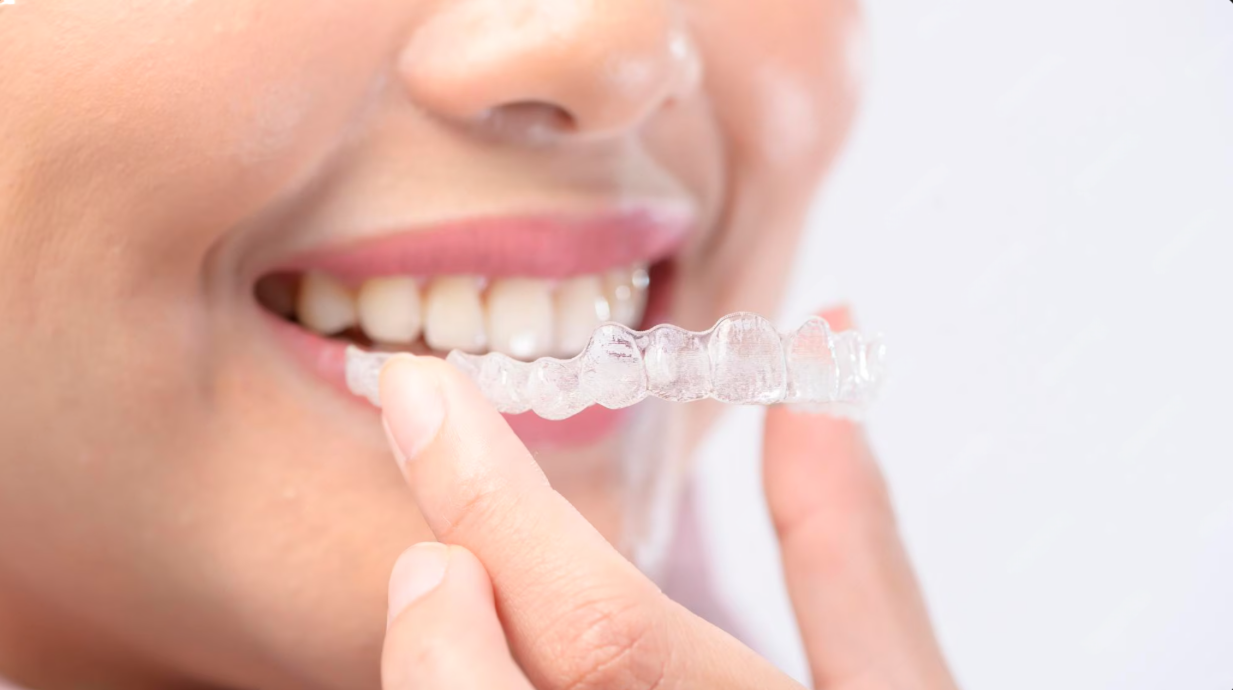 eating and drinking with invisalign